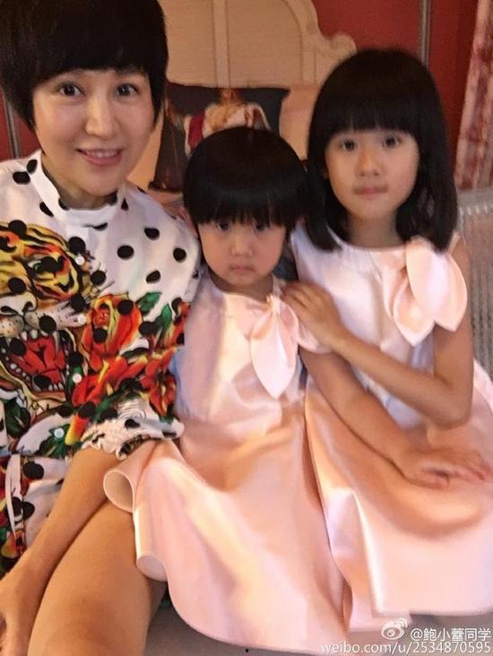 鲍蕾整容爆料视频播放大全,揭秘明星美容秘密